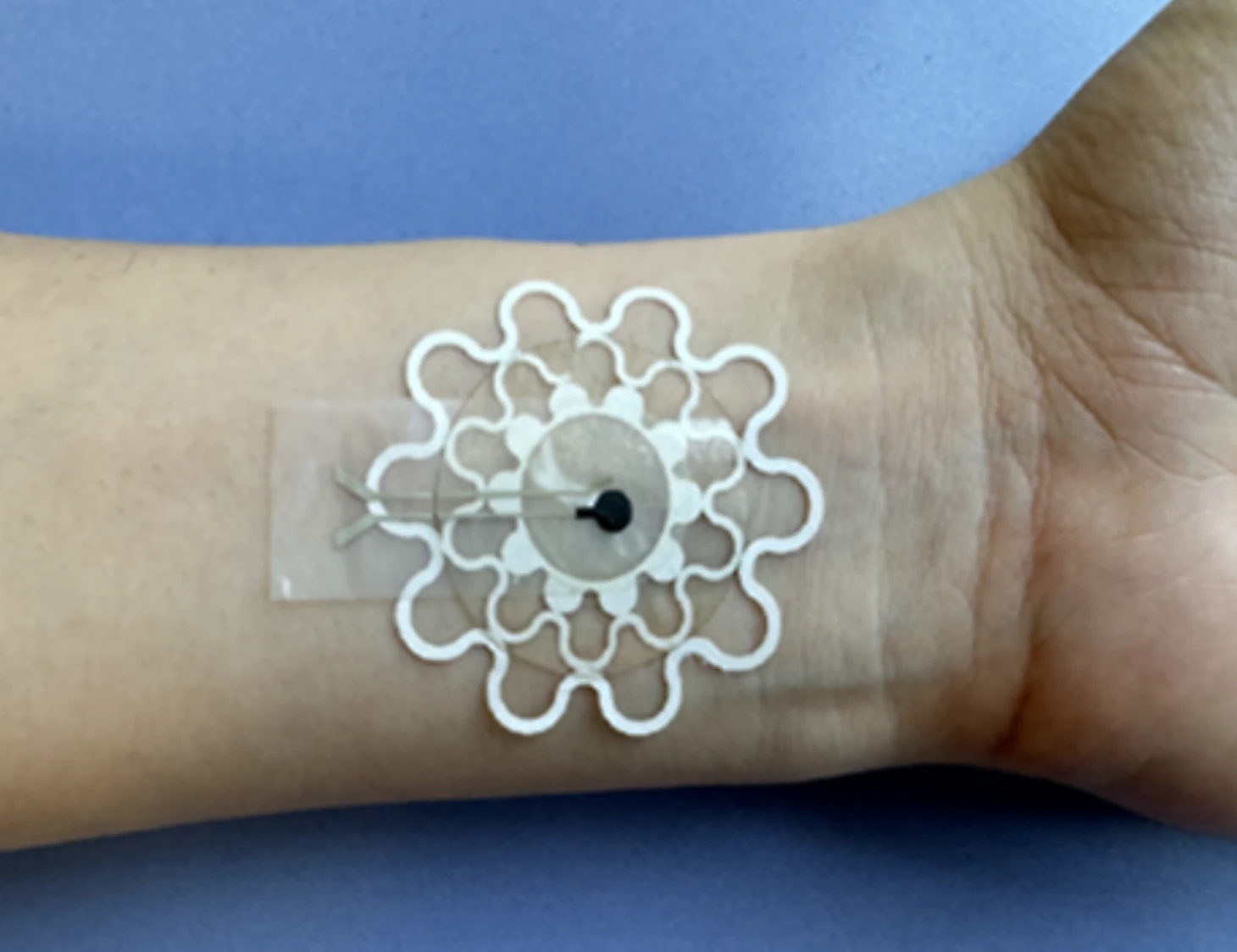 Hydrogel electrochemical wound-pH sensing patch worn on the wrist